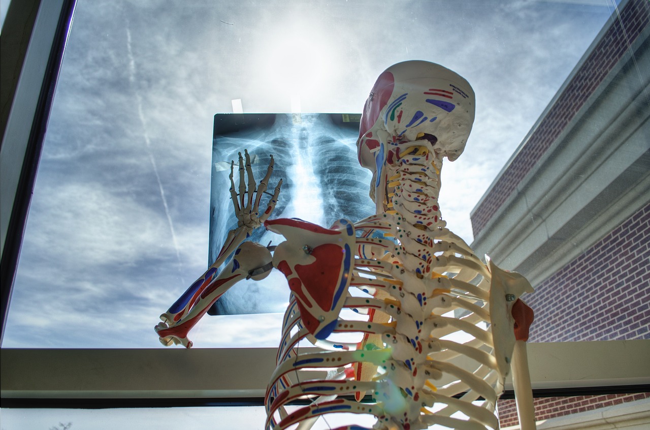 skeleton, medical, technology, medicine, tools, x-ray, skeleton, skeleton, skeleton, x-ray, x-ray, x-ray, x-ray, x-ray