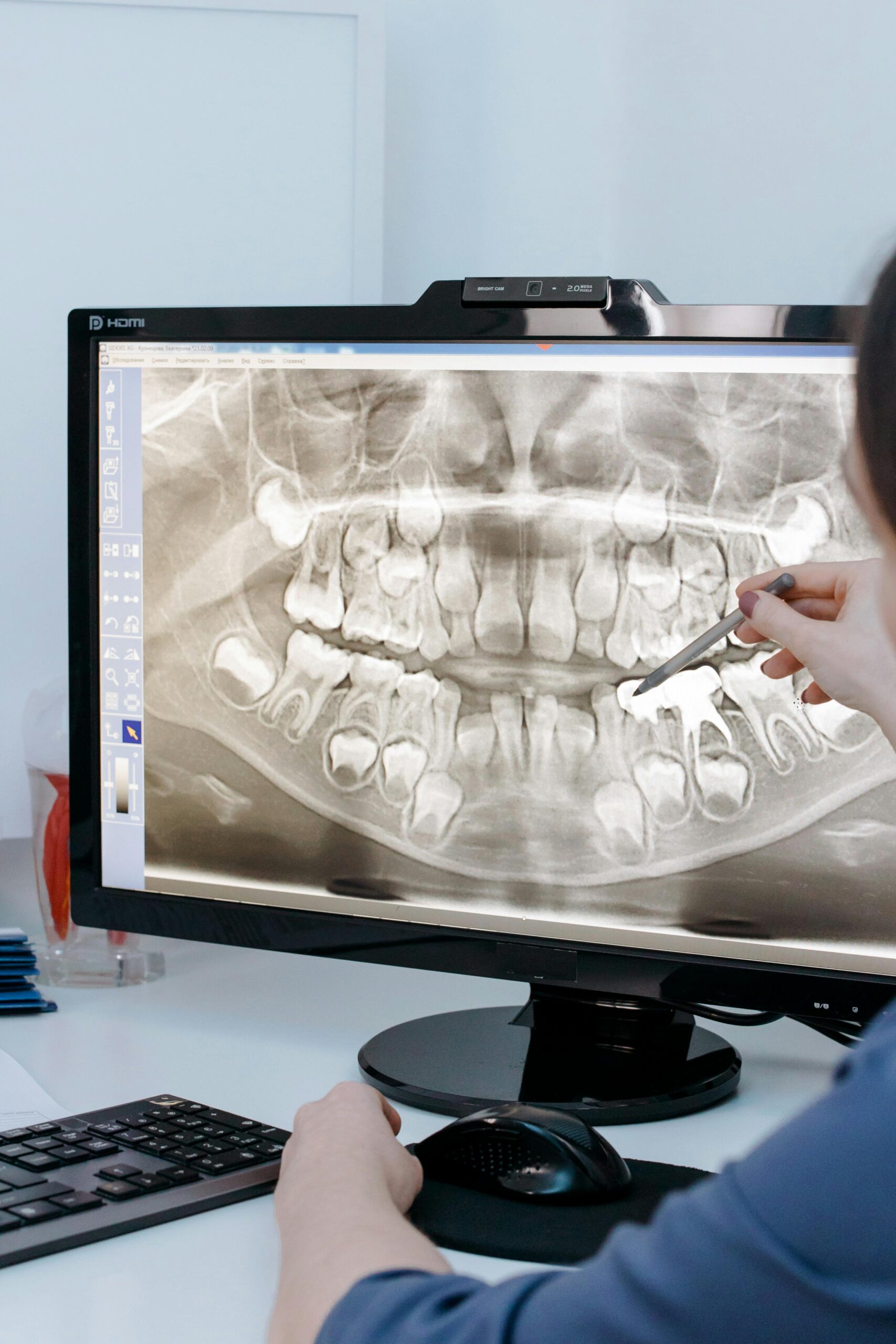 A dentist reviews a patient's dental X-ray image using a computer screen and pen.